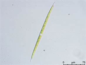 Closterium limneticum